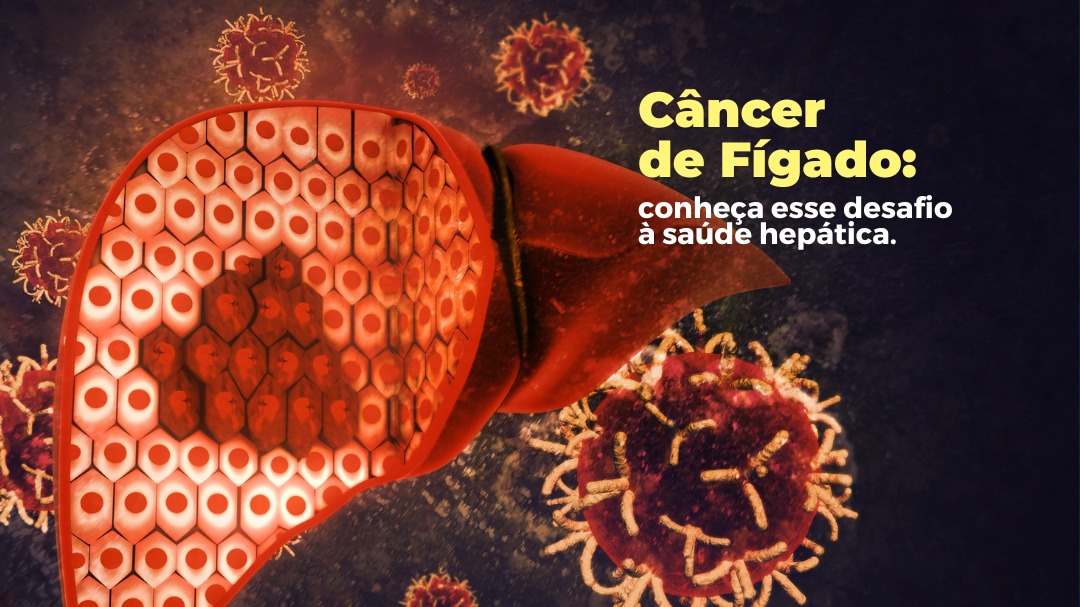 Câncer de Fígado: conheça esse desafio à saúde hepática